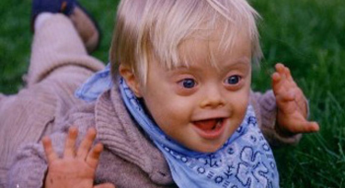Down-Syndrome-3.jpg