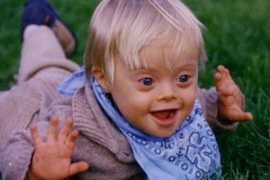Down-Syndrome-3.jpg